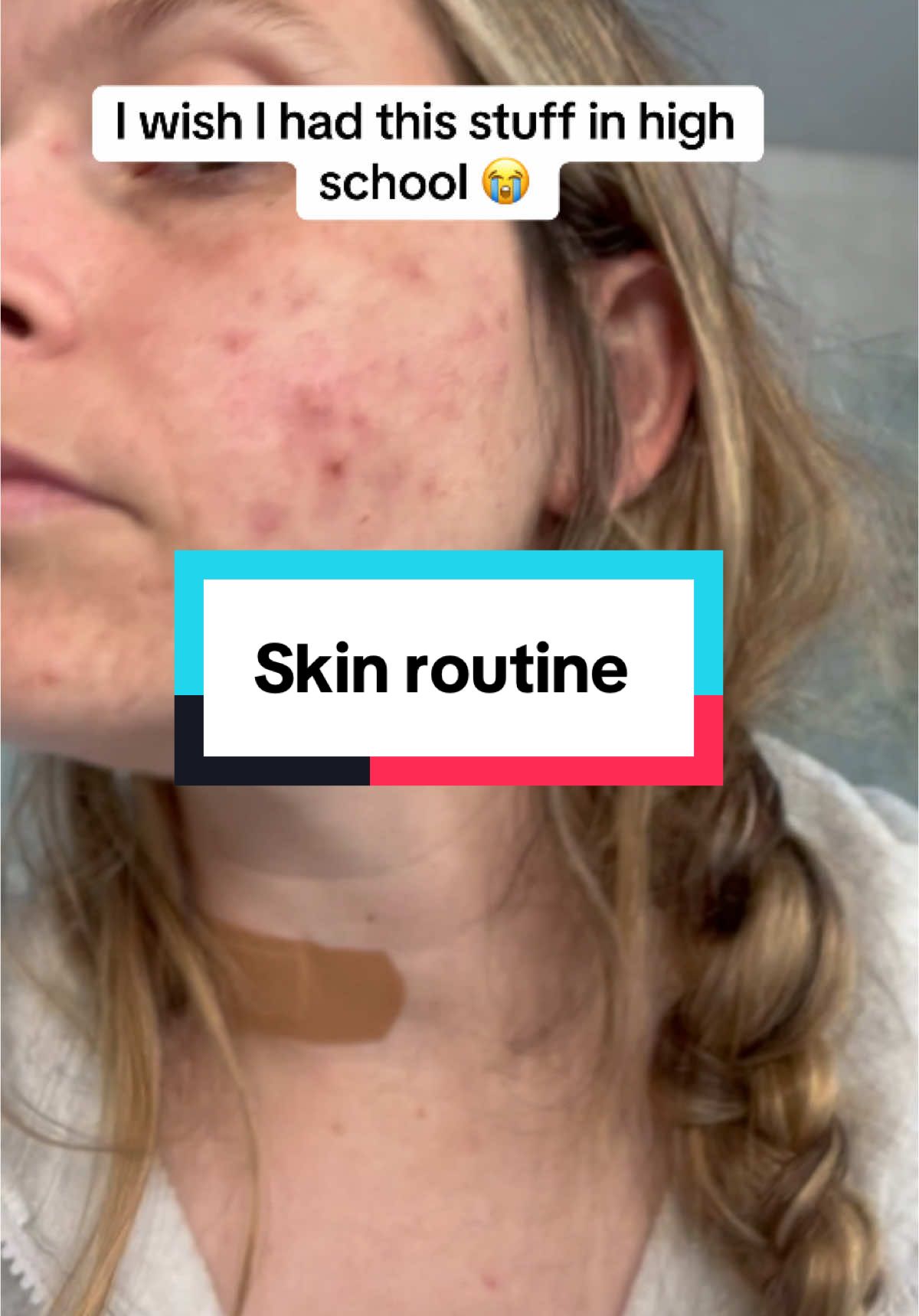 @Gopure #acne #skincareroutine #skincare #OOTD #grwm #transformation #moisturizer #wrinkles #antiaging 