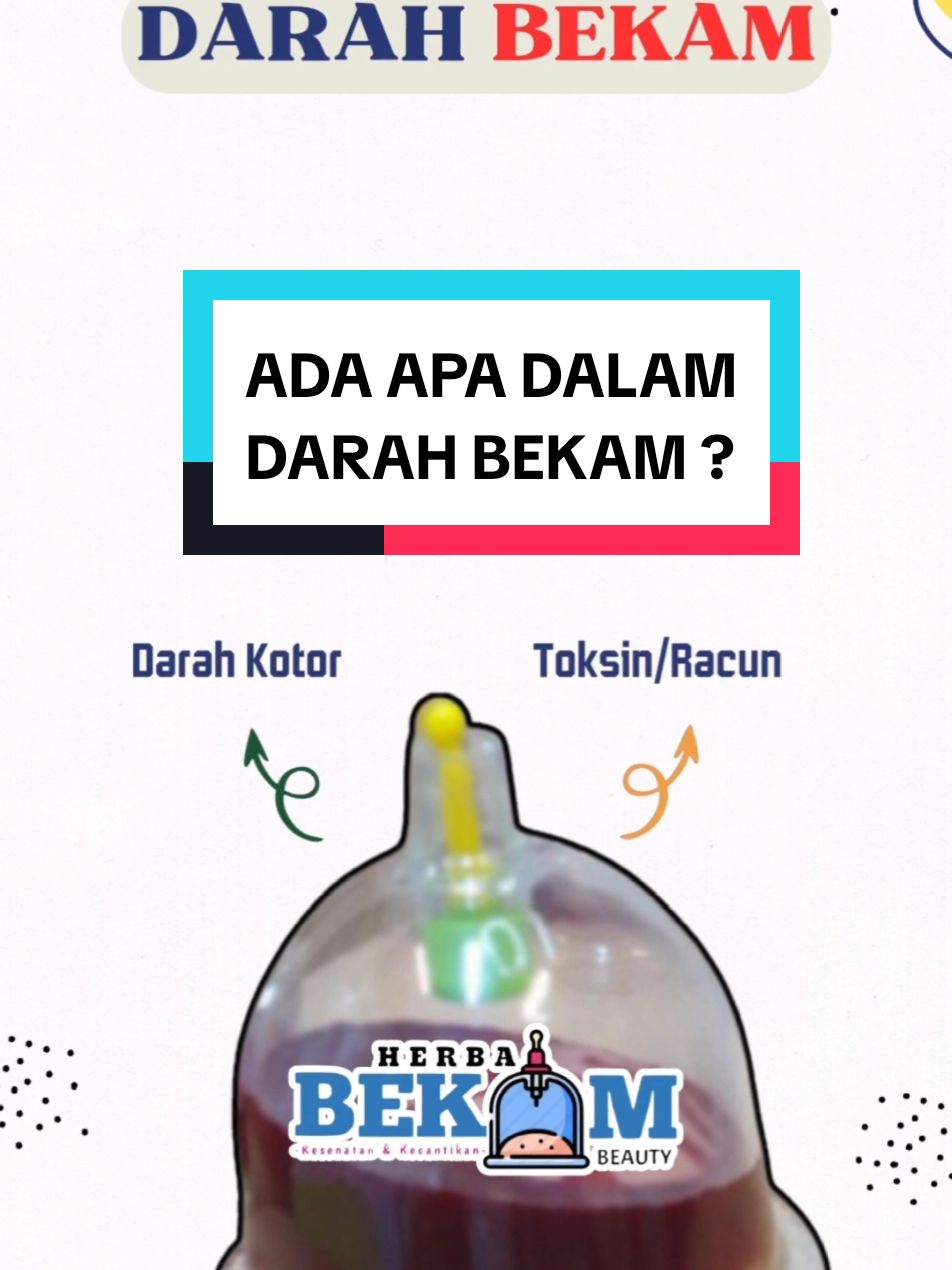 #cuppingtherapy #cupping #bekamjakarta #fyp #tiktok #bekam #hijamah #hijama #bekambekasi #bekamdepok #bekambintaro #bekamsumedang #bekambandung #darahkotor #darah #bekampria #bekamwanita #bekamangin #kolesterol #hipertensi #asamurat #stroke #vertigo 