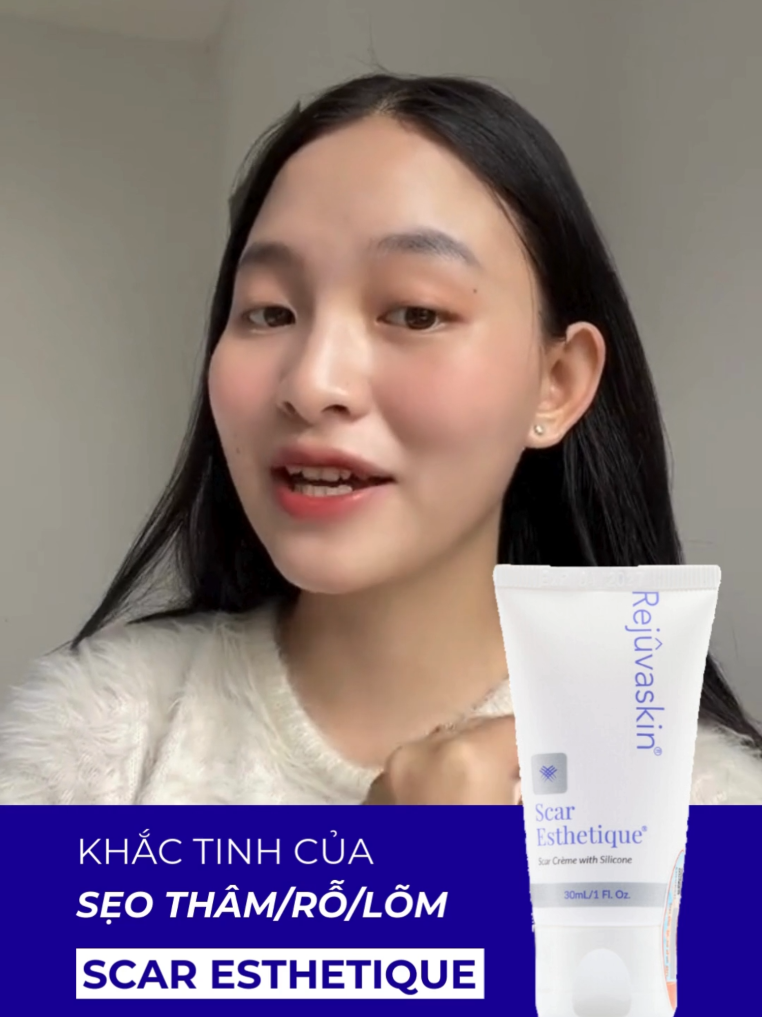 Cải thiện đáng kể sẹo thâm sau khi sử dụng Scar Esthetique #rejuvaskinvietnam #rejuvaskin #kemtriseo #rejuvasil #scaresthetique #seotham #seoloi #duongam #miengdanseo