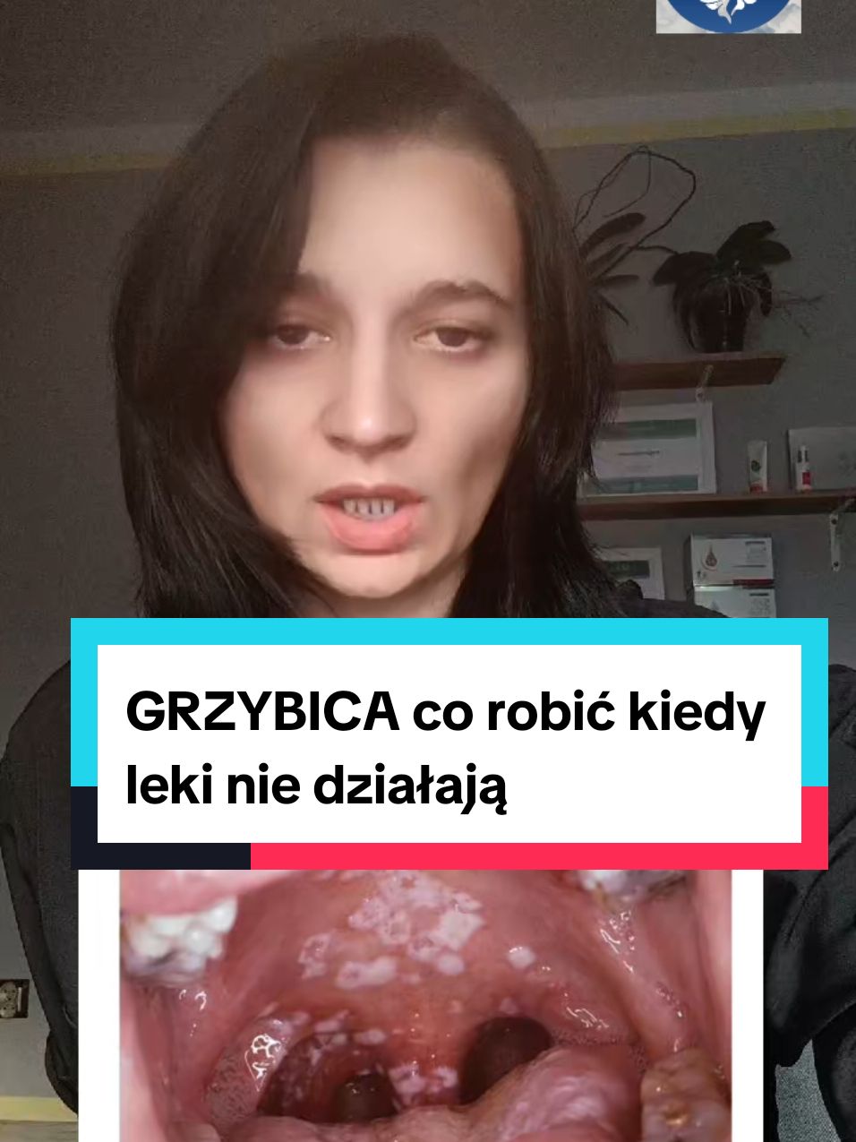 #grzybica #obrzeki #plesniawki #afty #zajady #bialynalotnajezyku #bialepodniebienie #wzdecia #biegunki #bolebrzucha #przelewanie #kuracja #oczyszczenie #odkwaszenie #dc #dlaciebie #porady #tiktok #viral 