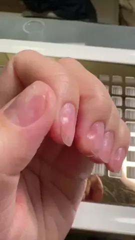 你是否因为灰指甲而感到困扰？指甲暗淡无光，失去了原本的健康状态？好消息来了！我们的专属修复指甲精油，将为你带来全新的指甲护理体验！#nailcare#nailoil#nails