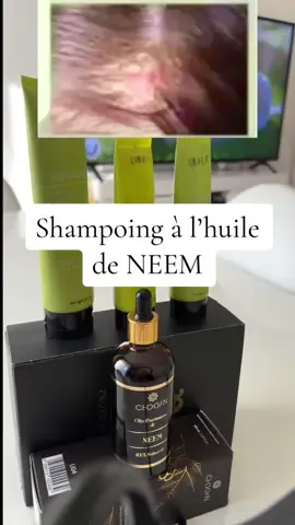 shampoing à l'huile de neem Aurodhea est le produit idéal pour les cheveux gras et à pellicules. Enrichi en huile de neem, il prévient la formation de poux et calme les démangeaisons. Ce précieux ingrédient se distingue également par d'autres fonctions importantes, telles que l'élasticité, l'hydratation, l'apaisement et l'anti-séborrhée. Le shampoing contient également de l'extrait d'ortie, qui se caractérise par ses propriétés équilibrantes et antipelliculaires. Enfin, le shampoing à l'huile de neem Aurodhea rend les cheveux plus forts, plus brillants et plus volumineux, tout en stimulant la repousse. TESTÉ SOUS CONTRÔLE DERMATOLOGIQUE #Huiledeneem #مغتربات_ايطاليا #مغتربات_فرنسا #chogan 