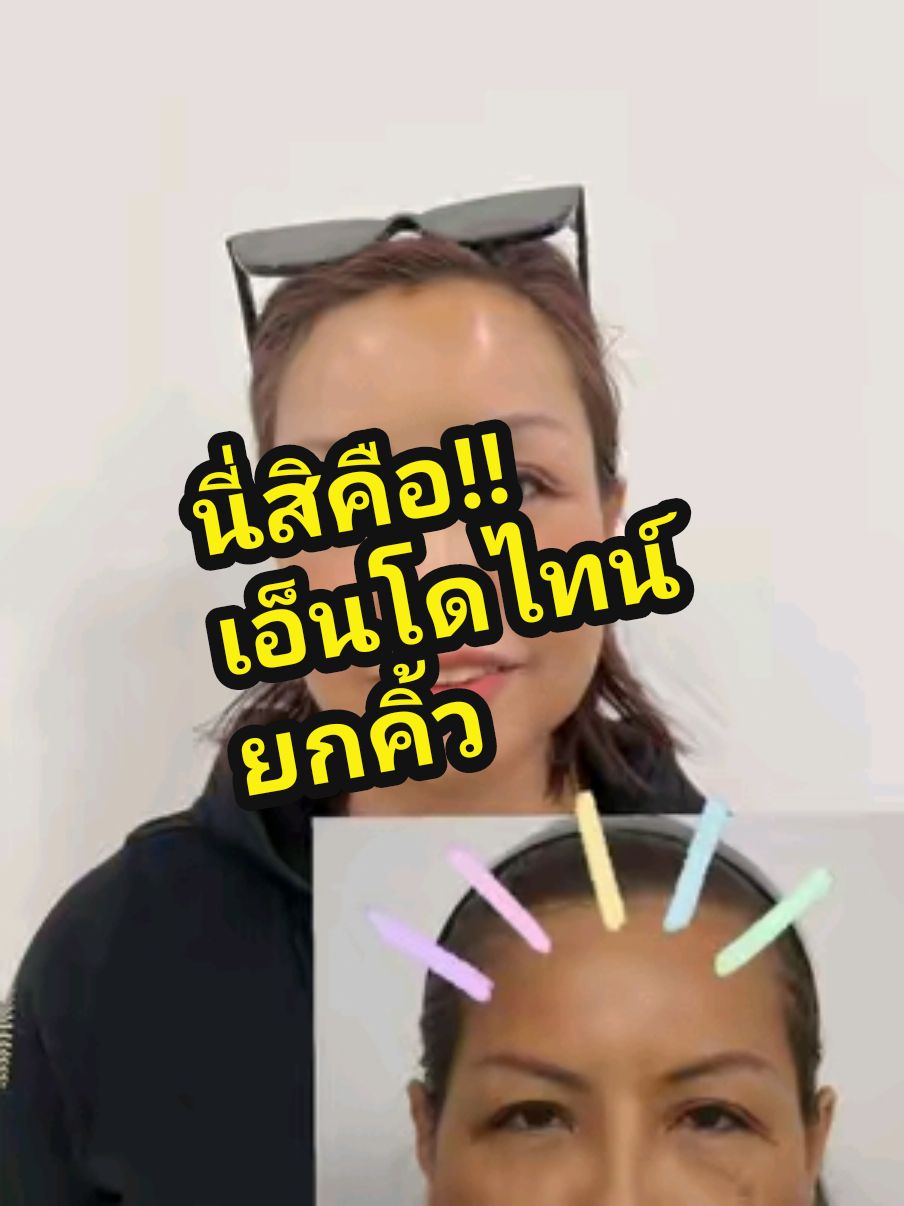 ย้อนวัย แบบยาวๆ ส่องกล้องดึงถึง5จุด#ศัลยกรรมเปลี่ยนชีวิต #ลูกสาวm01 #m01โรงพยาบาลศัลยกรรมเพื่อคนไทยโดยแท้ทรู #m01 #ยกคิ้ว 