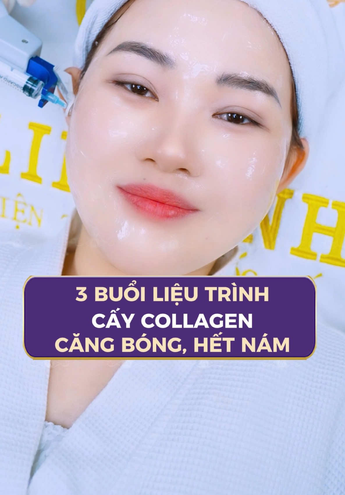 SẠCH NÁM - DA CĂNG BÓNG chỉ sau 3 buổi CẤY COLLAGEN! Ưu đãi cực hấp dẫn cho chị em đến 65%, nhanh tay đăng ký ngay!!! #thammylinhanh #lamdep #caycollagen #trehoada #dacangbong #namda #tannhang 