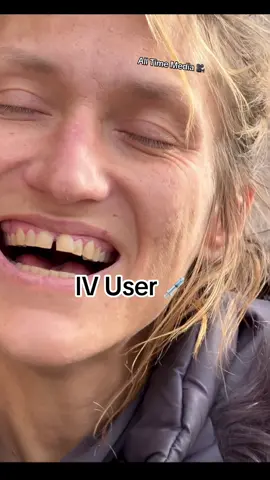 Jess Is An IV User 💉🥺😳 #fyp #foryou #battles #struggles 