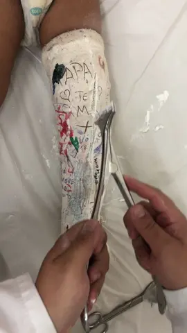 Crek crek…. #asmr #asmrsounds #asmrgesso #viral #fyp #fypdong #explore #explorar #fyyyyyyyyyyyyyyyy #asmrvideo #fyy 