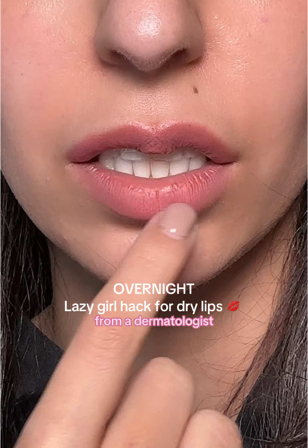 for the juiciest hydrated lips in the morning 💦👄💁🏽‍♀️ #dermatologist #dradel #skintok #skincare #skincareroutine #skincareproducts #drylips #drylipshack #hydratedlips #lipbalm #lipcare #lipcareroutine #skinhacks #foryou #fyp 