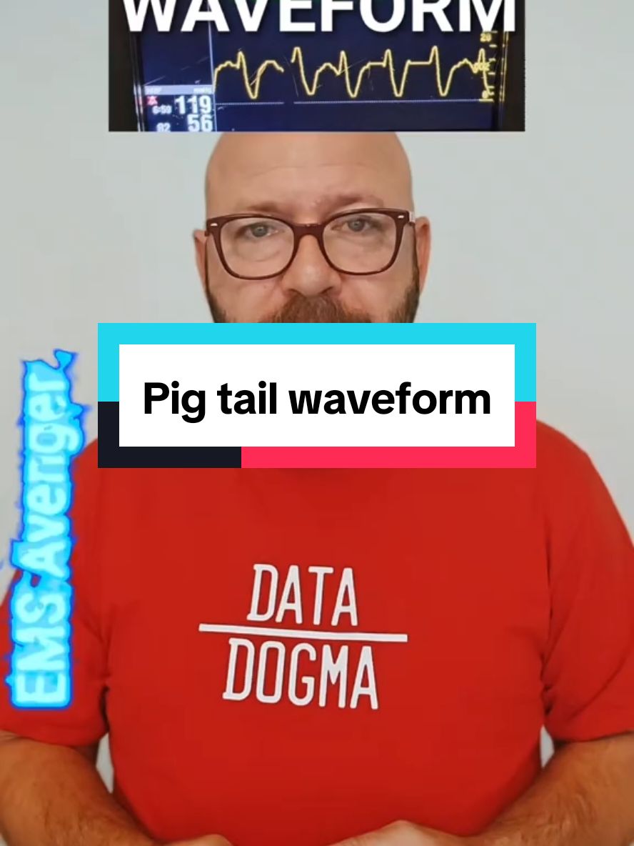 #onthisday You know about the regular ETCO2 waveform (The fair square), and the shark Fin (Nope Slope) wave form. But how about the pigtail? #fyp #Paramedictok #paramedicsoftiktok #medicsoftiktok #medictok #emtsoftiktok #emstok #Paramedic #paramedics #firstresponders #firstrespondertok #firstrespondersoftiktok #firefightertok #firefightersoftiktok #paramedicstudent #emtstudent #emstiktok #emergencymedicine #ambulance #ambulancetok #911 #paramedicstudentsoftiktok #emtstudent #emtstudents #emtstudentsoftiktok  #nursetok #nursesoftiktok #nurse #nurse #rntok #rnsoftiktok  #CriticalCare #CriticalCareParamedic #CriticalCareParamedicsoftiktok #CriticalCareTok #CriticalCareofTikTok #FlightParamedicsoftiktok #FlightParamedictok #FPC #CCPC  #Firemen #FiremenofTikTok #firemanTok #FireMedic #FireMedics #FireMedicsofTikTok #cardiacarrest #OHCA #resuscitation #FOAM #FOAMED #FOAMEMS #12lead #12leadecg #12leadekg #Cardiology