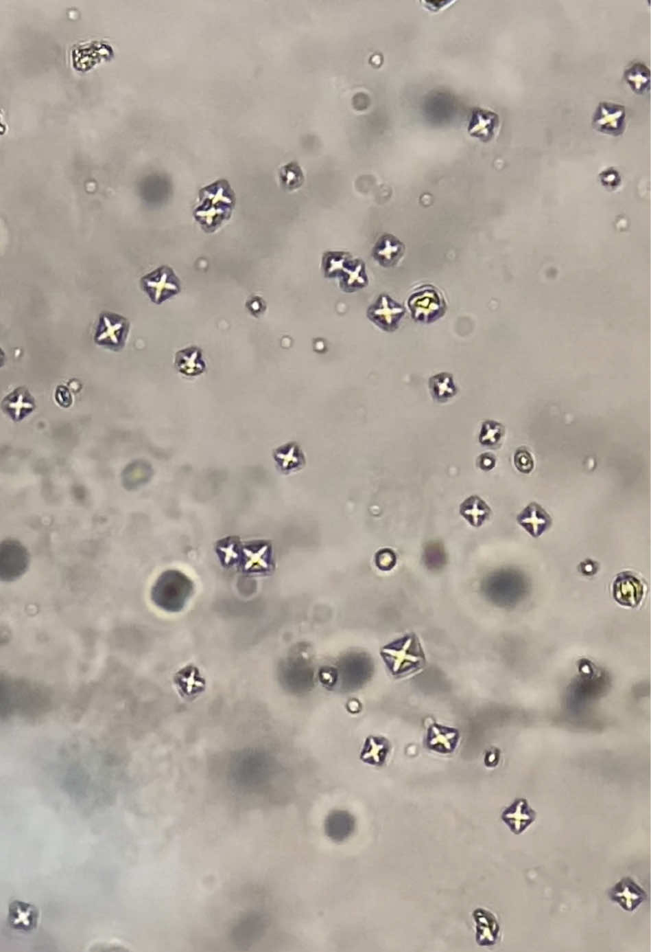 CALCIUM OXALATE CRYSTALS DIHYDRATE FORM (WEDDELLITE) CaOx in urine sample of a 9-year old male patient #calciumoxalatecrystals #urinecrystals #caoxurine #crystalsinurine #caoxdihydrate #RMT #clinicalmicroscopy #medtech #medlabscientist #mtle #mtle2024 #medtechboardexam #medtechtok #medtechlife #microscopy