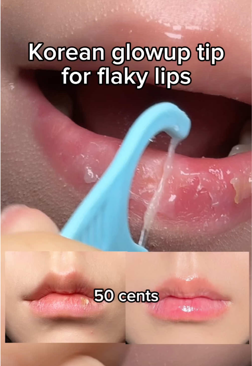 Are your lips dry&cracked?#creatorsearchinsights #drylips #koreanglowup #lipcare #lipcaretips 