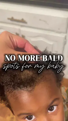 Me & this hair growth oil go together real bad 😂 #hairoil #baskandlatherco #hairgrowth #hairgrowthtips #hairgrowthoil: #hairgrowthtips #hairgrowthoil #hairgrowthproducts #healthyhair #blackfridaydeals #tiktokshopblackfriday