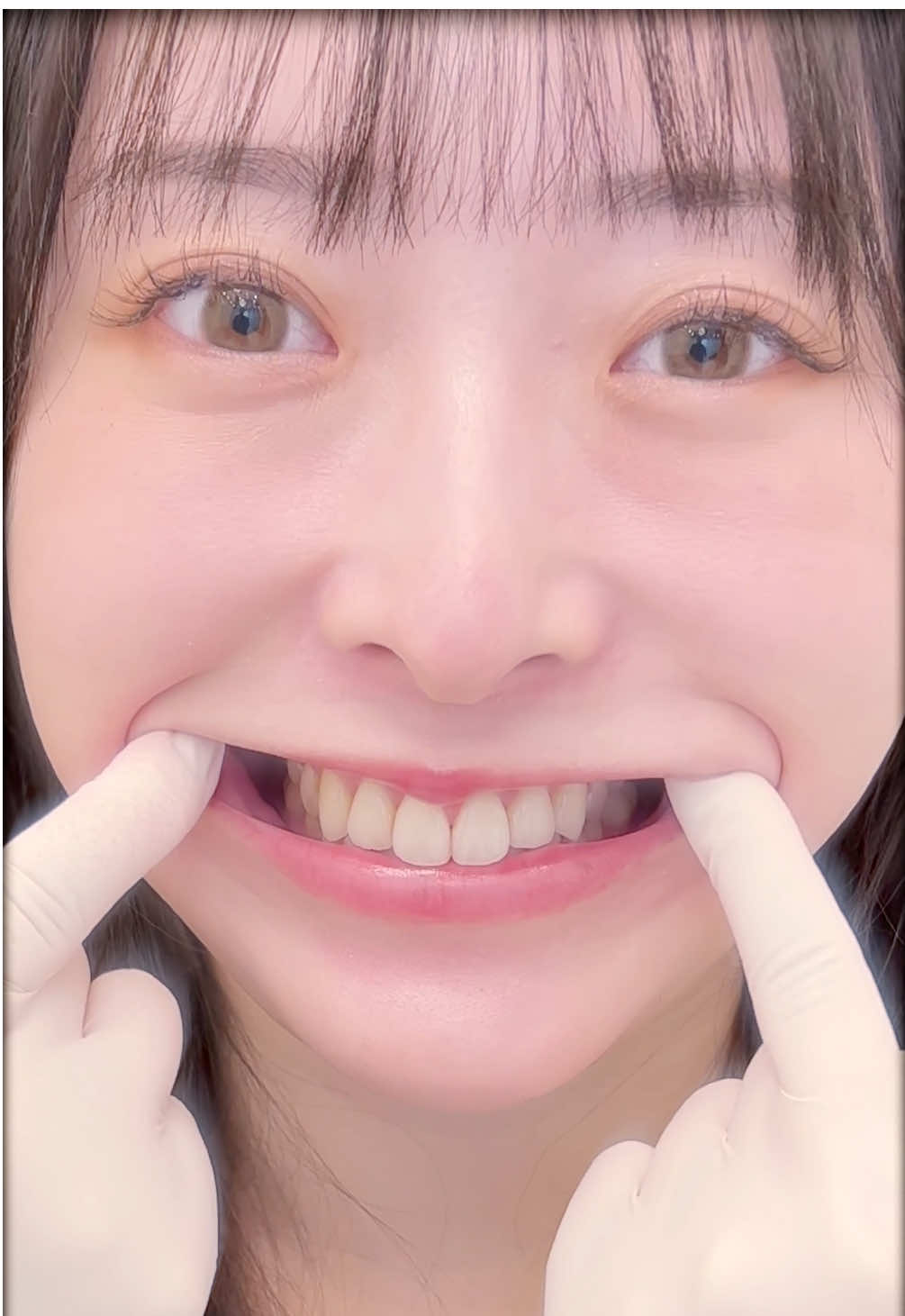 綺麗な歯は毎日の歯磨きから✨ #dental #Aクリニック #歯医者 