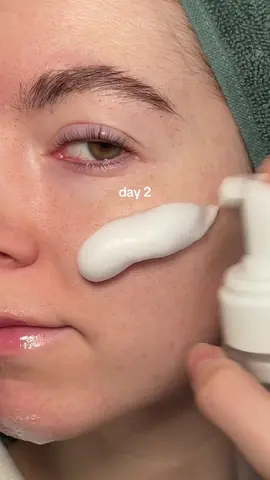 #ad Up and personal with @delphyr_official 🫧🤍 . #skincare #koreanskincare #kbeauty #pores #skintok #blackhead #glassskin #toner #koreantoner 