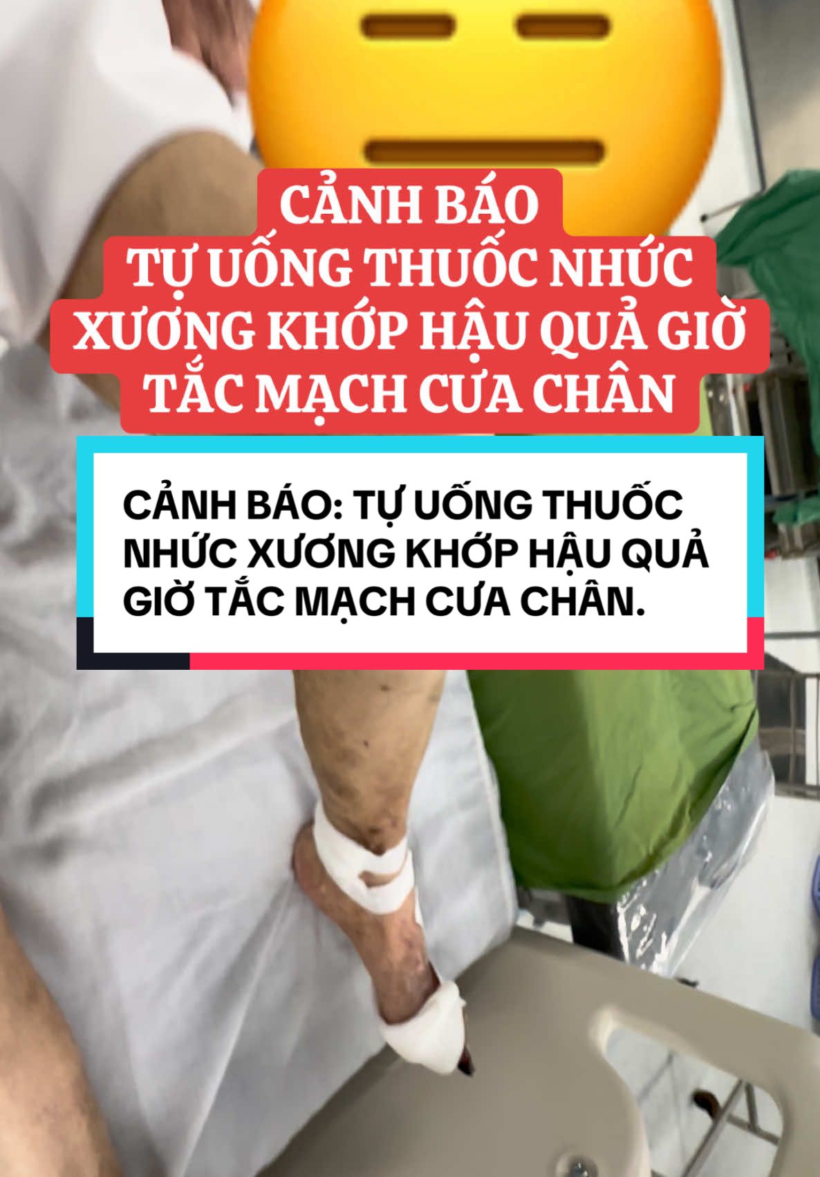 CẢNH BÁO TỰ UỐNG THUỐC NHỨC XƯƠNG KHỚP HẬU QUẢ GIỜ TẮC MẠCH CƯA CHÂN#xuongkhop #kiengiang #corticoid 