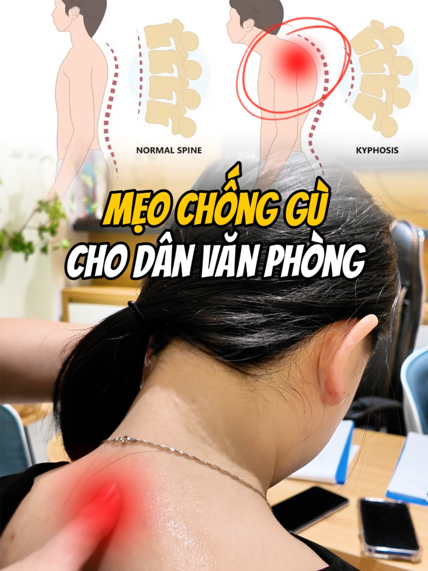 Mẹo chống gù, đau mỏi vai gáy cho dân văn phòng #chamsocsuckhoe #viencoxuongkhopsigma #vatlytrilieu #sigmacare #xhtiktok #thesigma #daumoivaigay