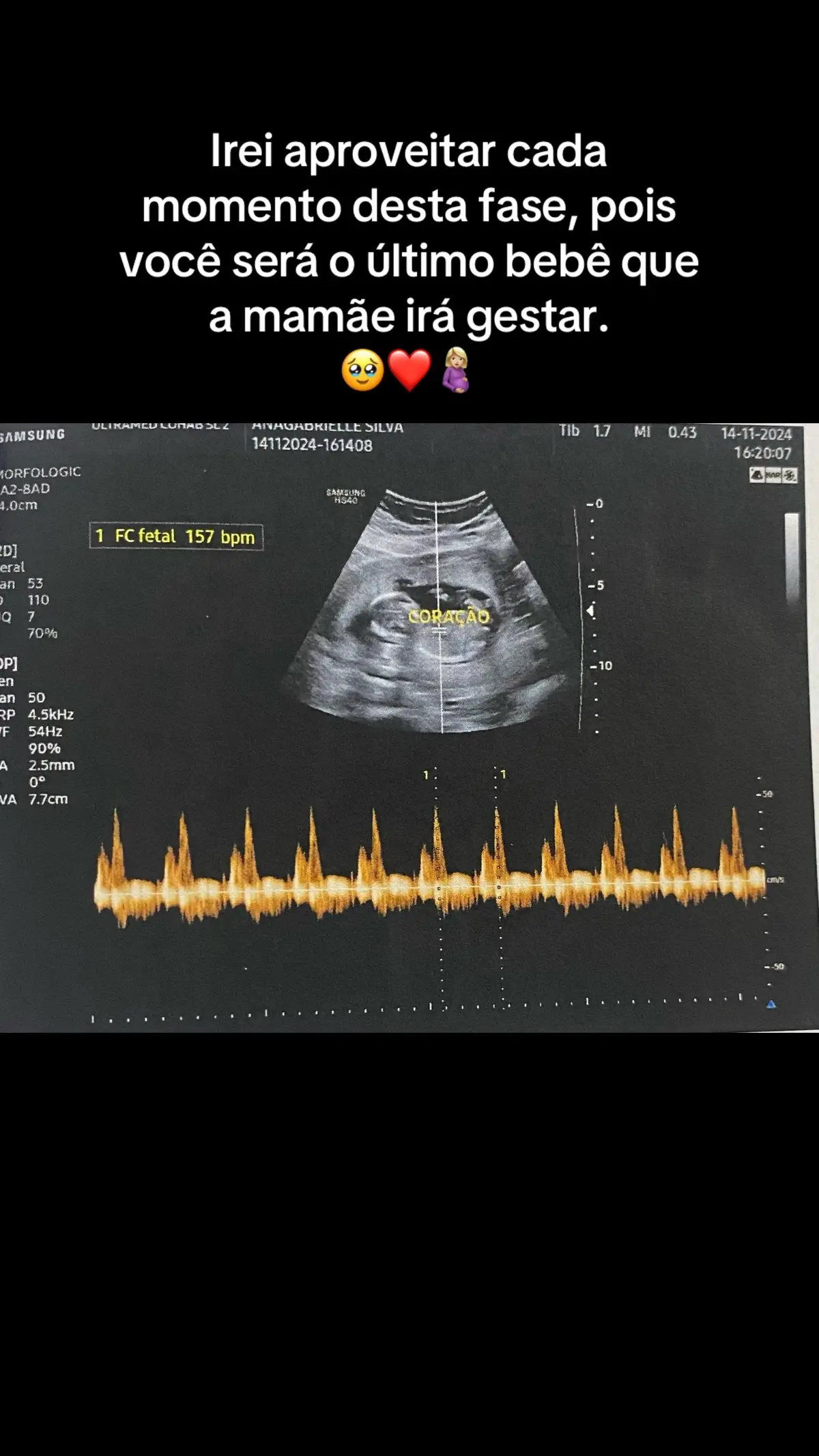 3ª Gestação 😍💜💚