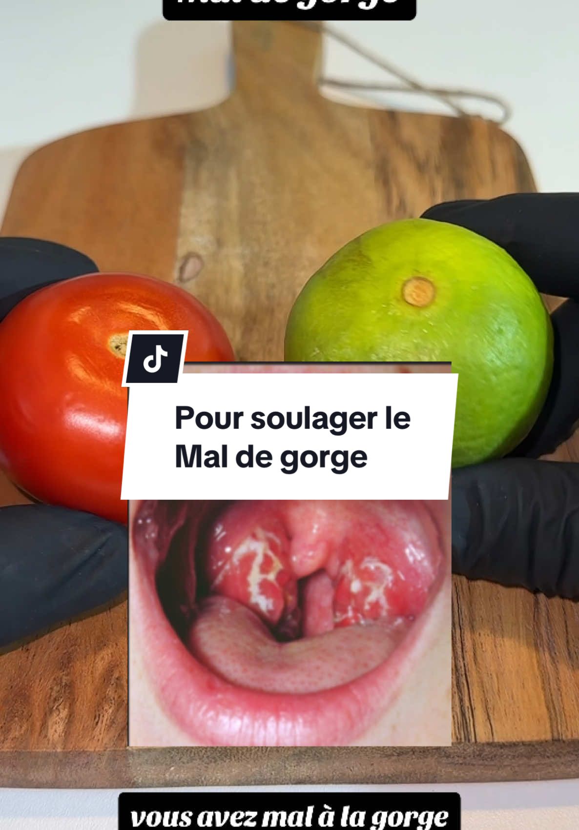 Pour soulager le Mal de gorge#gorge #recettefacile #bio #foruyou #forupage #antibiotiquenaturel #france #remedenaturel #fipシ  @وصفات  @وصفات  @وصفات 