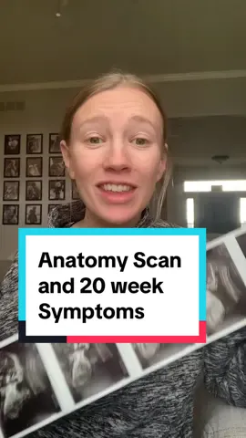 I had my anatomy scan over the holiday and here is what is going on with my baby at 20 weeks pregnany! Of course I am also talking about my pregnancy symptoms and showing you my baby bump at 20 weeks!  #babybump #anatomyscan #pregnancy #pregnant #pregnancyjourney #babythree #20weekspregnant #pregnancyupdate #bumpdate 