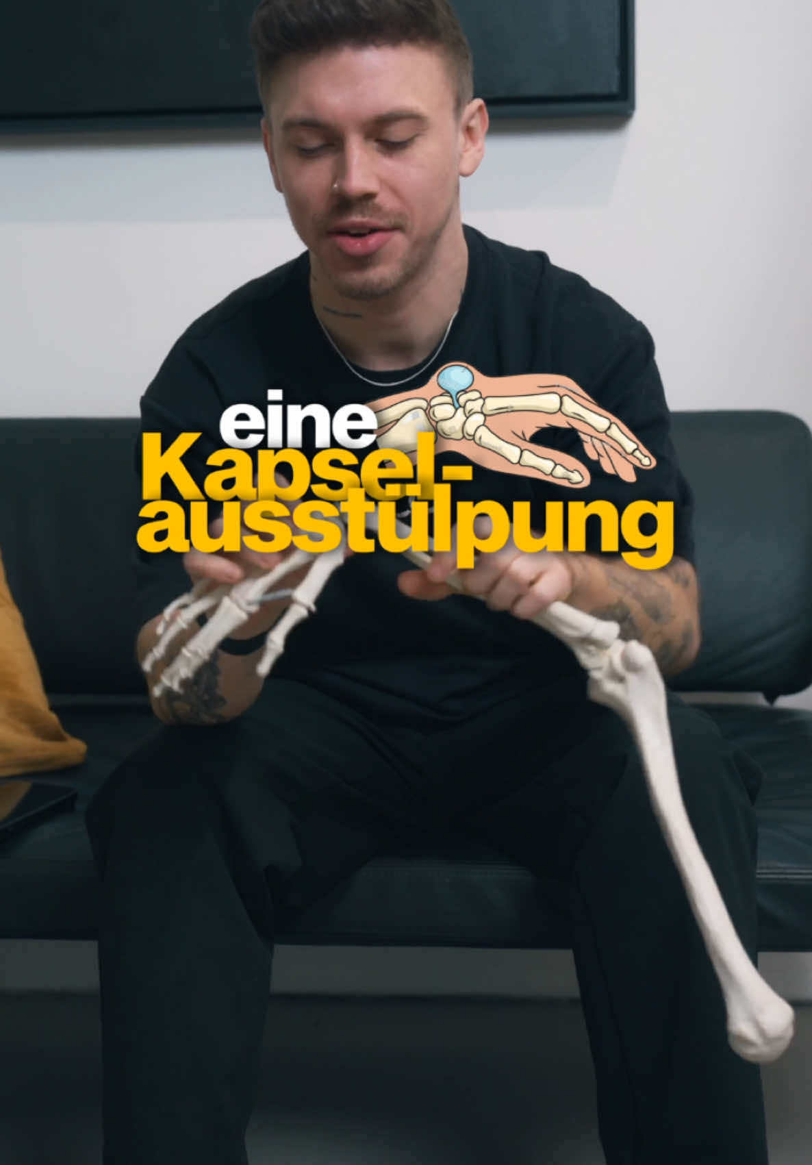 Dieses Video wurde mir extrem häufig zugeschickt. 👀Tatsächlich wird hier ein Ganglion zum platzen gebracht. Mein Orthopäde hat mir damals ebenfalls empfohlen, mit einem Buch auf meine Hand zu schlagen (hat nicht geklappt und tat weh 🥲). Daher empfehle ich euch nicht das selber zu machen. Es gibt deutlich schonendere Wege ein Ganglion los zu werden. 😁