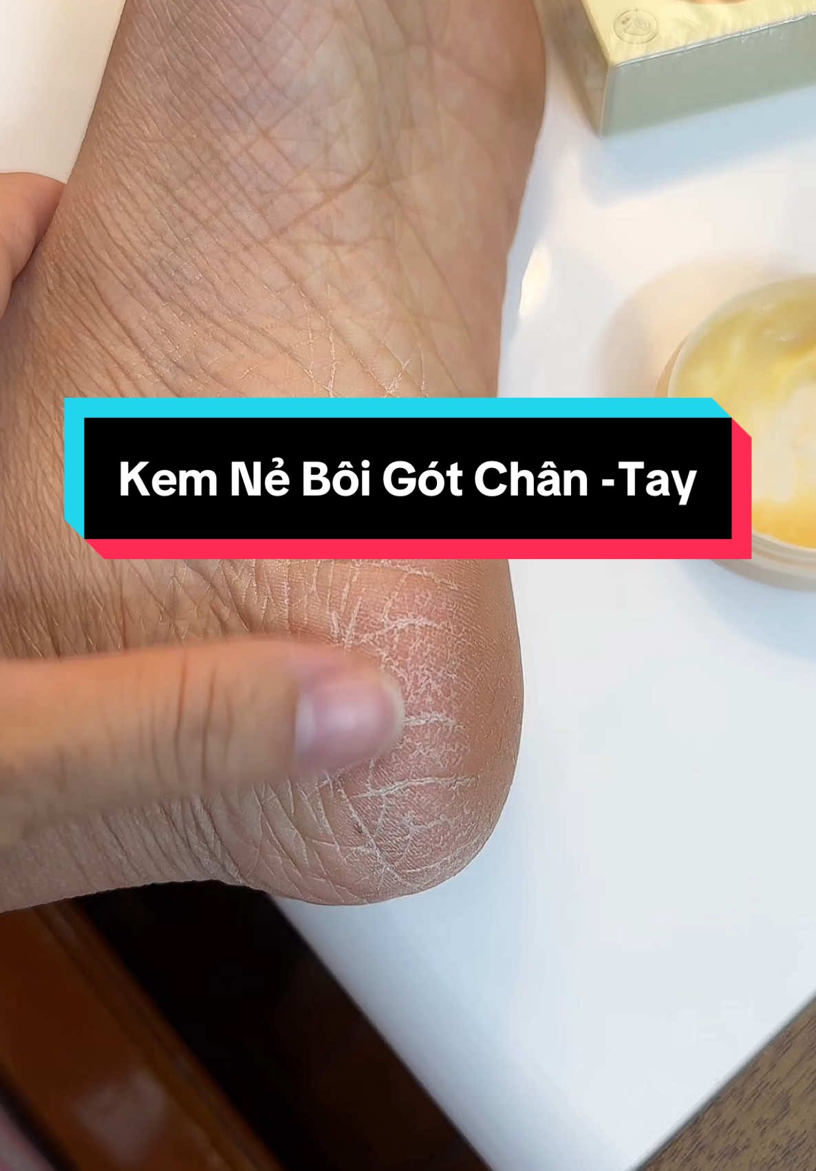 Gót chân bác nào nứt khô như em thì thử lọ sáp này nha! #kemne #muataitiktokshop #xuhuong 