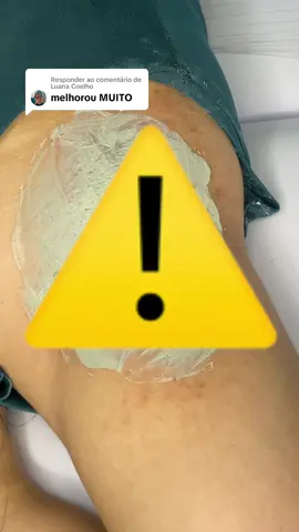 Respondendo a @Luana Coelho E esse foi o resultado da 2ª sessão de clareamento de axilas! GOSTOU DO RESULTADO? • • • #clareamentodeaxilas #gestante #axilasescuras #gravidez #depilación #fy #CAPCUT #foryou #axila