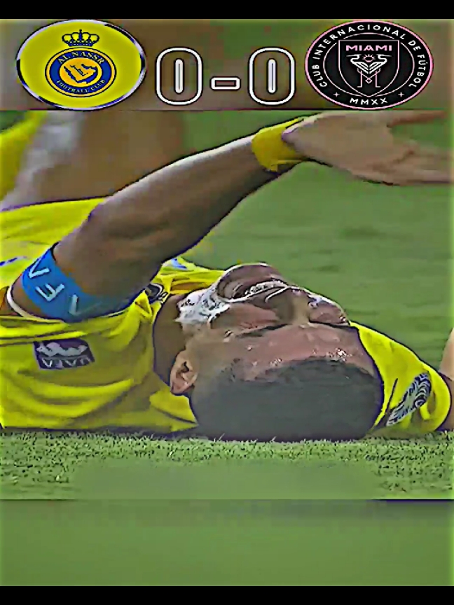 ملخص مباراة النصر 🆚 انتر ميامي  #تيم_مصممين_العيالة💎 #حـمـودي_كـريـس🔥 