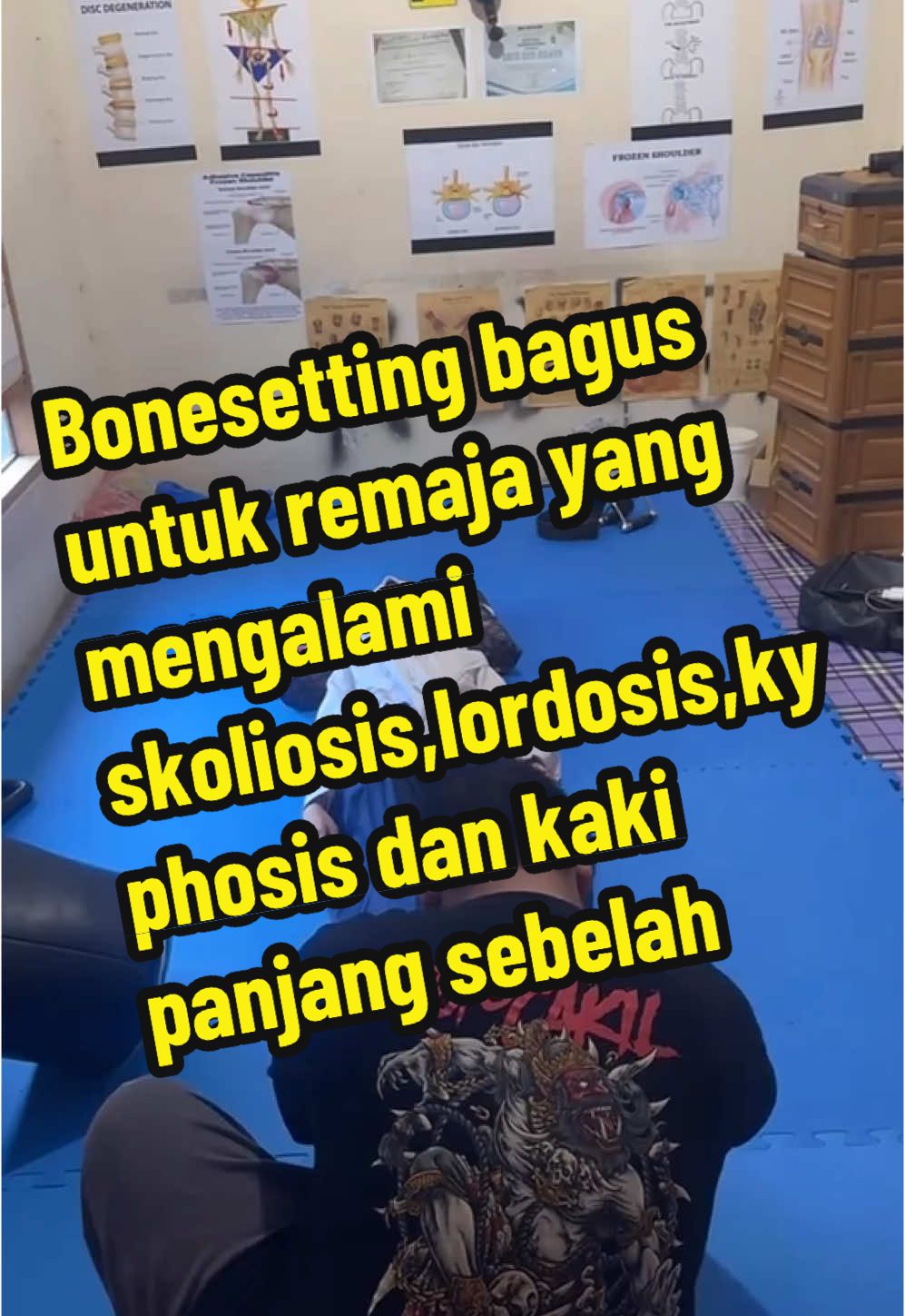 Penting nya pelemasan otot sebelum reposisi sendi CJQ7+GM5, Pandansili, Banyukambang, Kec. Wonoasri, Kabupaten Madiun, Jawa Timur 63157 ☎️ reservasi 0822-4599-7710…#p#pijatkretekb#bonesettinga#asmrkretekkretekm#masterkretekmadiunk#kretekabalabalk#kretekmadiunviral#k#kretekoriginalb#banyukambangk#kecamatanwonoasric#chiropracticb#bonesettingr#reposisitulangs#sangkalputungy#yumeihomassagegun