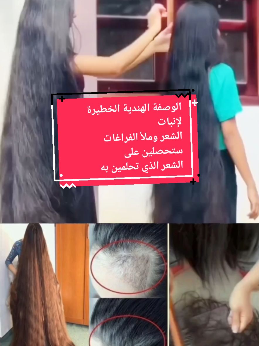 الوصفة المعجزة الهندية التي ستحيي بصيلات الشعر وستحصلين على الشعر الذي كنت تحلمين به  #وصفة_سهلة #وصفة_مجربة #وصفات_طبيعية #وصفات_سهله #تطويل_الشعر #تطويل_الشعر_ونعومة_مثل_الحرير #تطويل_الشعر_علاج_تساقط_الشعر #عناية_بالشعر #تساقط_الشعر #تساقط_الشعر_وعلاجه #تكثيف_الشعر #تكثيف_تطويل_انبات_الشعر #تقوية_الشعر #إنبات_الفراغات #pourtoii #explore #المغرب🇲🇦تونس🇹🇳الجزائر🇩🇿 #france#@dada_beauty_ma❤️ @dada_beauty_ma❤️ @dada_beauty_ma❤️ I