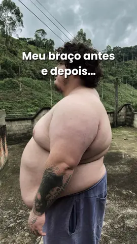 Braço de mortadela nunca mais 💪🏻 #obesidade #emagrecimento #motivação #evolução #viral