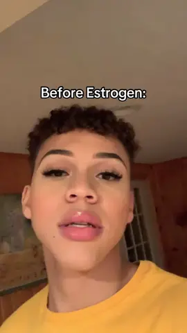 Oh and a few surgeries too😅😂 so thankful for gender affirming care💕✨ #transgender #transandproud 