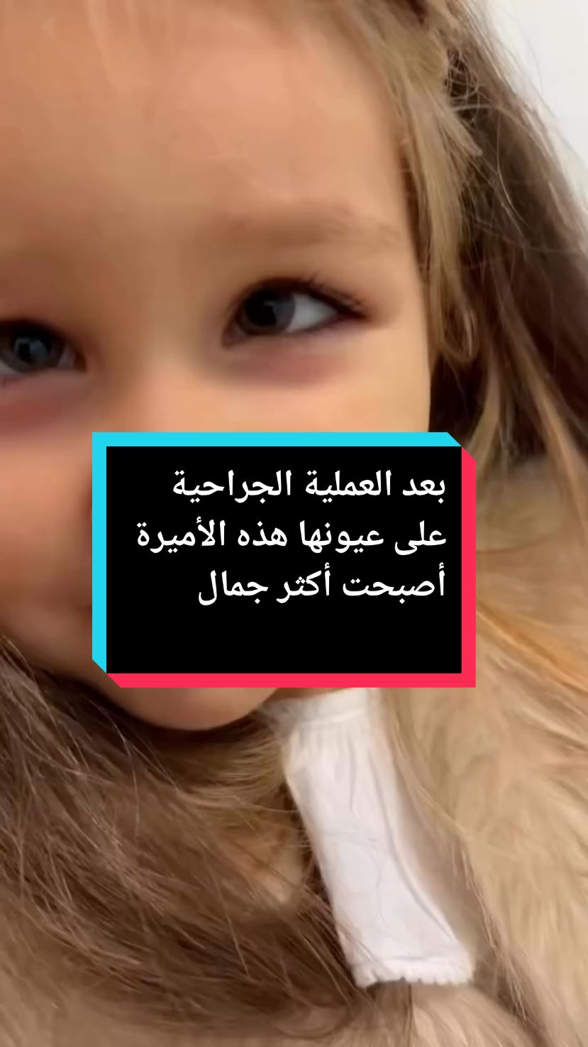 بعد العملية الجراحية على عيونها هذه الأميرة أصبحت أكثر جمال🥹🥰 #بنوته #كيوت #ابنتي_الصغيرة #عيونك_حلوين #مفاجأة #الجمال_الحقيقي #اميرتي_الصغيره #fyp #viral_video #foryoupagе #explore #🇩🇿🇲🇦🇹🇳 @Lotfi Lotfi 