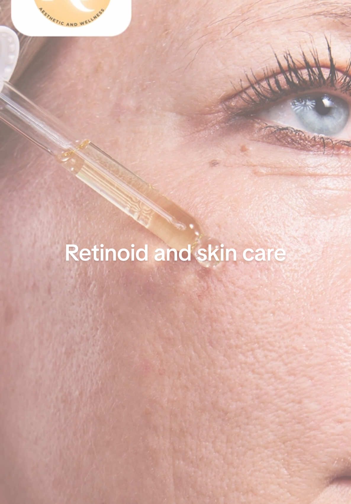 *Beginner-Friendly Retinoids (Gentle Options)* The Ordinary Retinol 0.2%  La Roche-Posay Retinol B3 Serum CeraVe Resurfacing Retinol Serum *Intermediate Retinoids (Stronger but Still Gentle)* Paula’s Choice 0.3% Retinol  Avène RetinAL 0.1 Intensive Cream *Advance retinoids or prescription strength retiniods                             Adapalene.                                         So, whether you’re just starting out or upgrading your routine, there’s a retinoid for everyone. *Start low and go slow, Use a pea-sized amount, Start from once or twice a week ,Always follow with sunscreen during the day Trust me, your skin will thankyou!              #retinolskincare #retinoids #retinol #tretinoin #gentleretinol #retinolbeginners #retinolbenefits #glowuptipsbeforesummer 