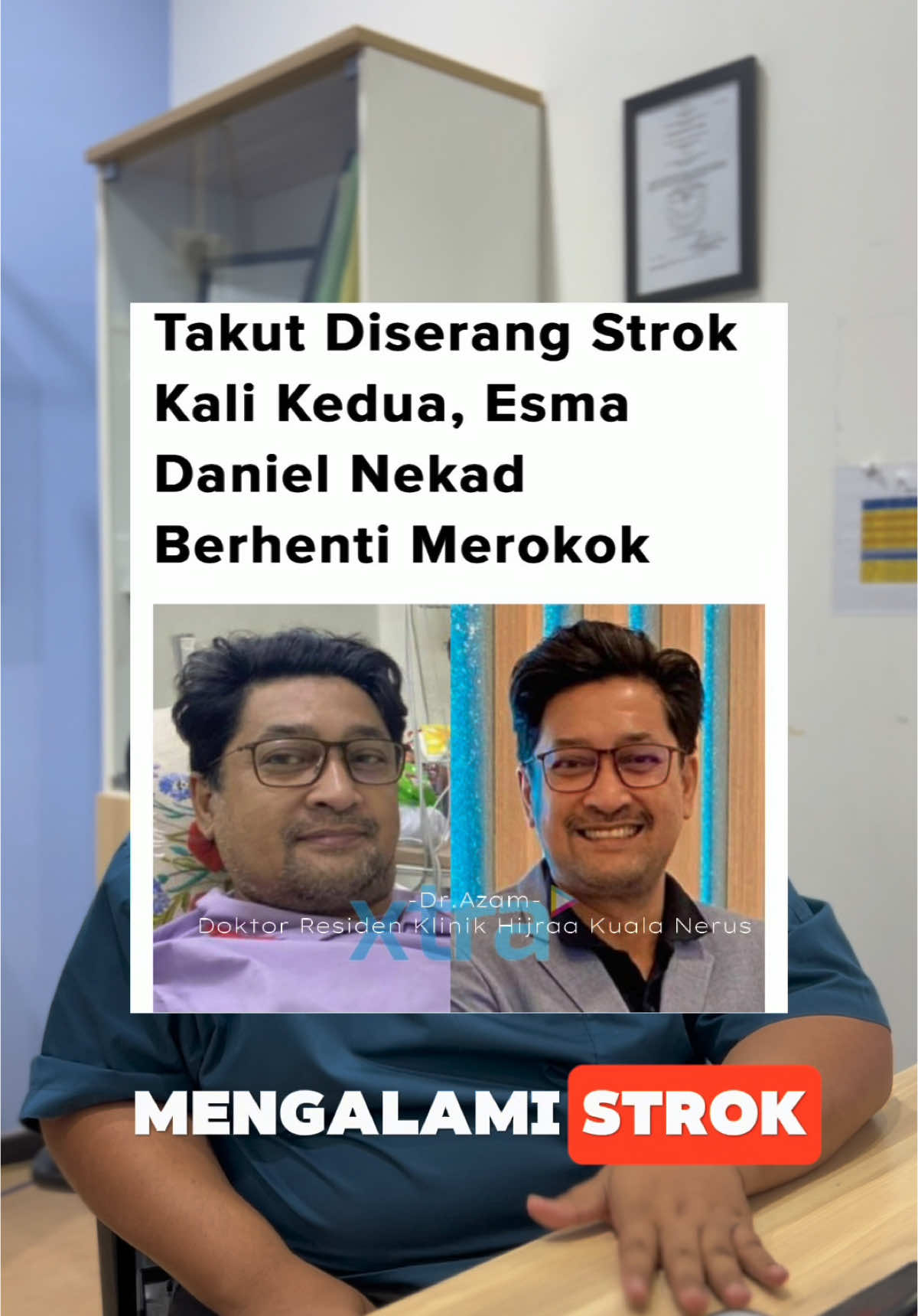 anda berkemungkinan terkena strok jika anda penghidap penyakit komorbid (kencing manis,darah tinggi, dan kolesterol) yang tidak terkawal. perhati setiap ciri ciri utama strok dan segera ke hospital jika tanda-tanda ini ada pada diri anda atau orang terdekat. #stroke #strok #kencingmanisdarahtinggi #kolesterol #medicalcheckup 