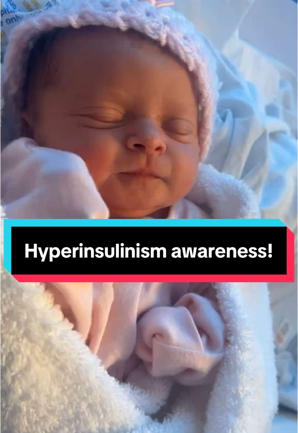 I wanna try spread a bit  of awareness here. These jittering/shaking movements are not normal in a newborn. Midwifes dismissed me saying it was normal. I asked multiple people within the ward before being discharged my concerns if my daughters movement.  and was told it was normal. Resulting in us being dishcarged and her bluelighted to hospital with dangeriously low blood sugars. The signs of hyperinsulinsim is hard to spot. But jittering movements like this is easy to spot and a simple blood glucose sample could saved so much trauma and gotten her the help she needed sooner. I want to use this platform to spread awareness as its only 1-25000 babies that are born with it. Knowing the signs of hypoglycaemia could save a babys life!! #awarenessmatters #hyperinsulinism #newbornbaby #babymovements #notnormalfriends 