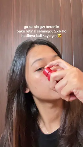 kalo ga nyoba ga bakal tau hasilnya ga sih🥲 #retinal 