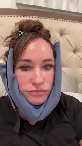 #unitedstates #trending #fypシ #fypシ゚viral #plasticsurgery #recoverytiktok #pain #tiktokfriends #update