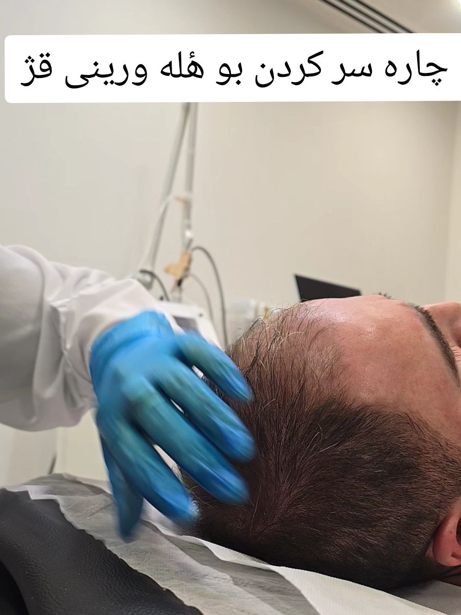 #beuty #UK #londan #mhp #foryoupage #hairfiller #clinic #aesthetic #skincare #Birmingham #UK 