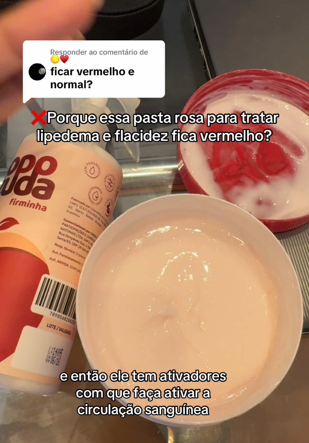 Respondendo a @🌕♥️ eu tô amando!  💖 #estrias #lipedema #flacidez #foliculite 