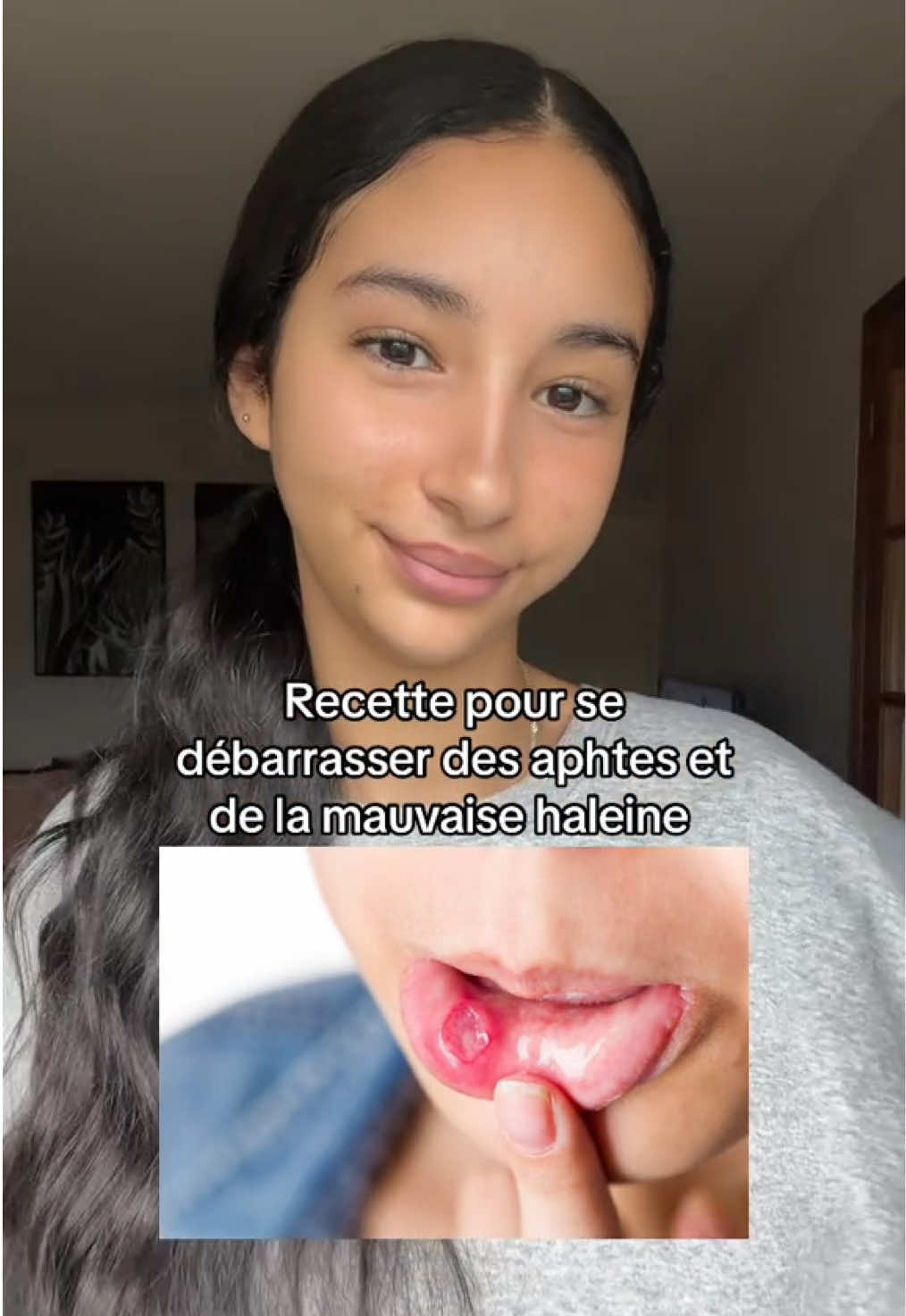 #pourtoi #fyp #BeautyTok #fy #foryoupage #foryou #dent #devinelapersonne #maison #recette #dentist #tiktok #bouche #aphtes 