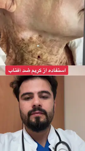 کریم ضد آفتاب