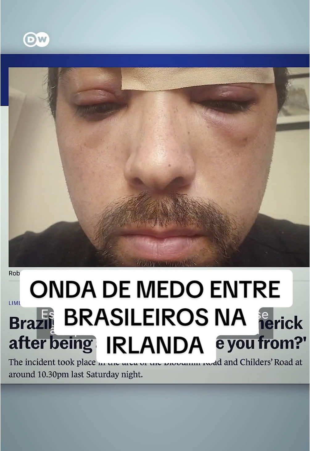 O que está acontecendo com os brasileiros na Irlanda? Por que eles estão com tanto medo? #dw_brasil #deutschewelle #irlanda #brasileiros #violencia #europa #estrangeiros #imigrantesbrasileiros