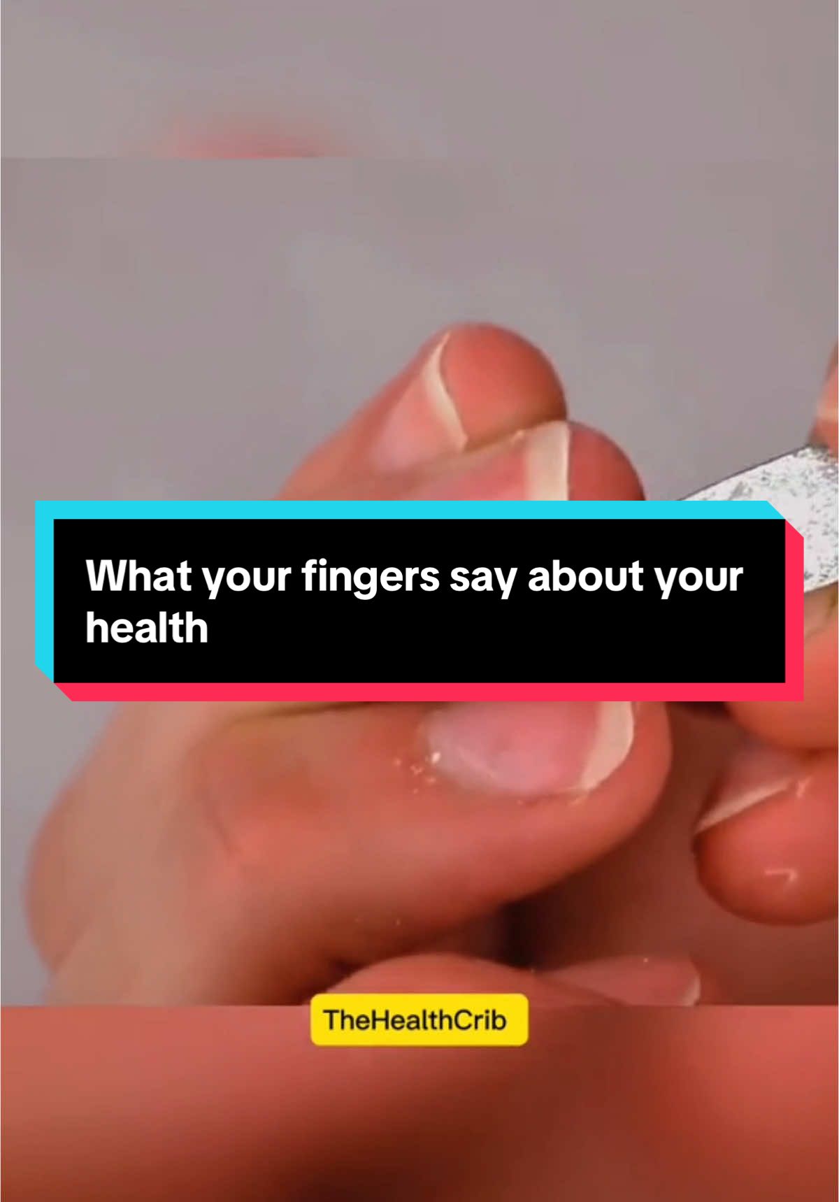 What your fingers say about your health 