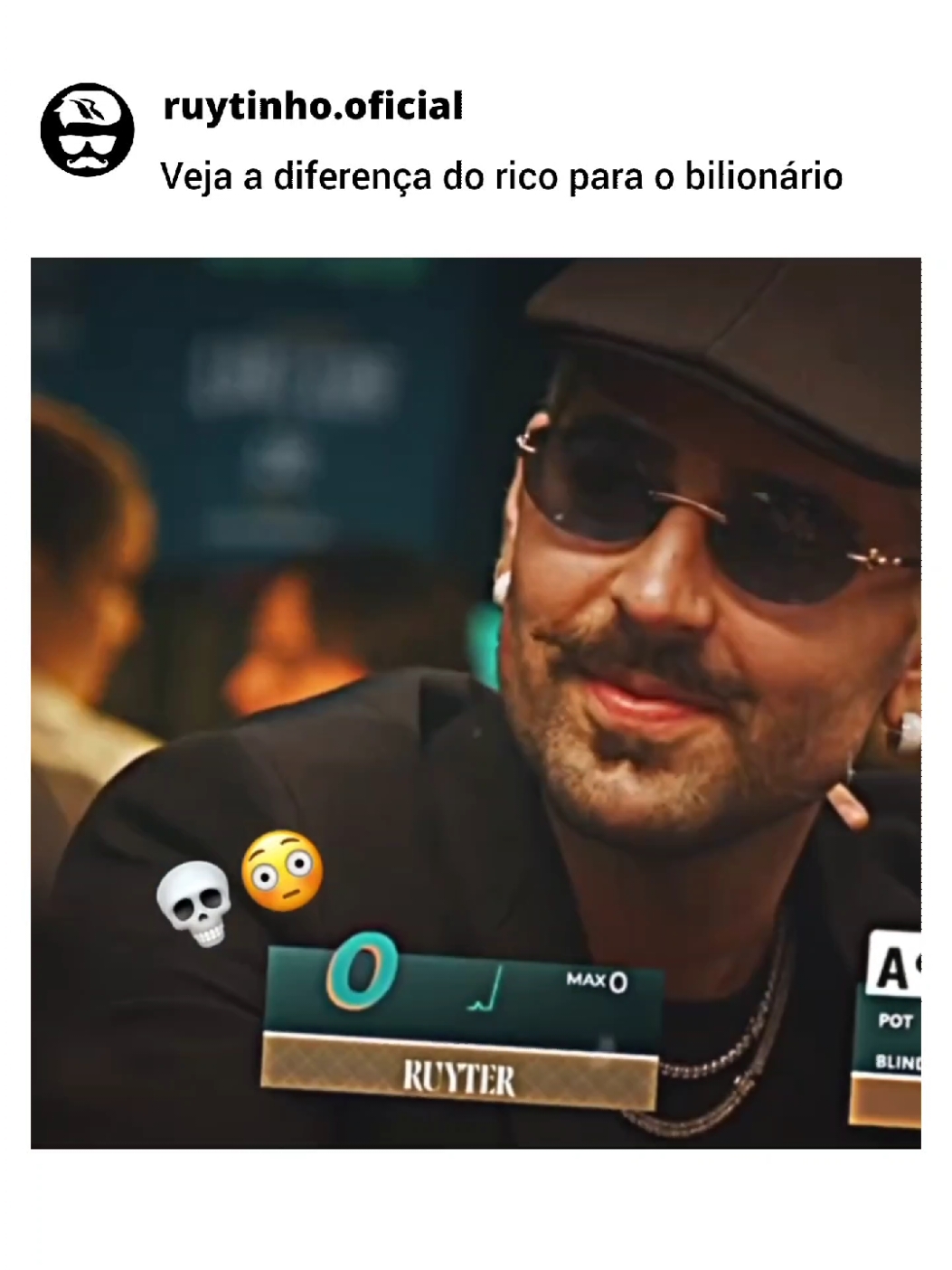 viu a diferença? #ruyter #videoviral #explore #foryou #ruyterpoubel 