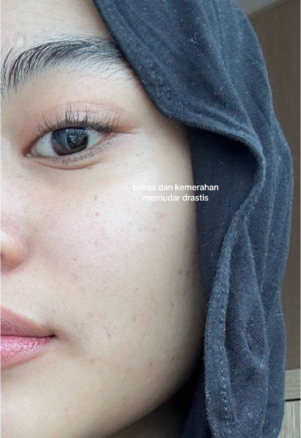 sungkem dulu sama produk ini deh #cerahbarengelsheskin #glowwithelsheskin 