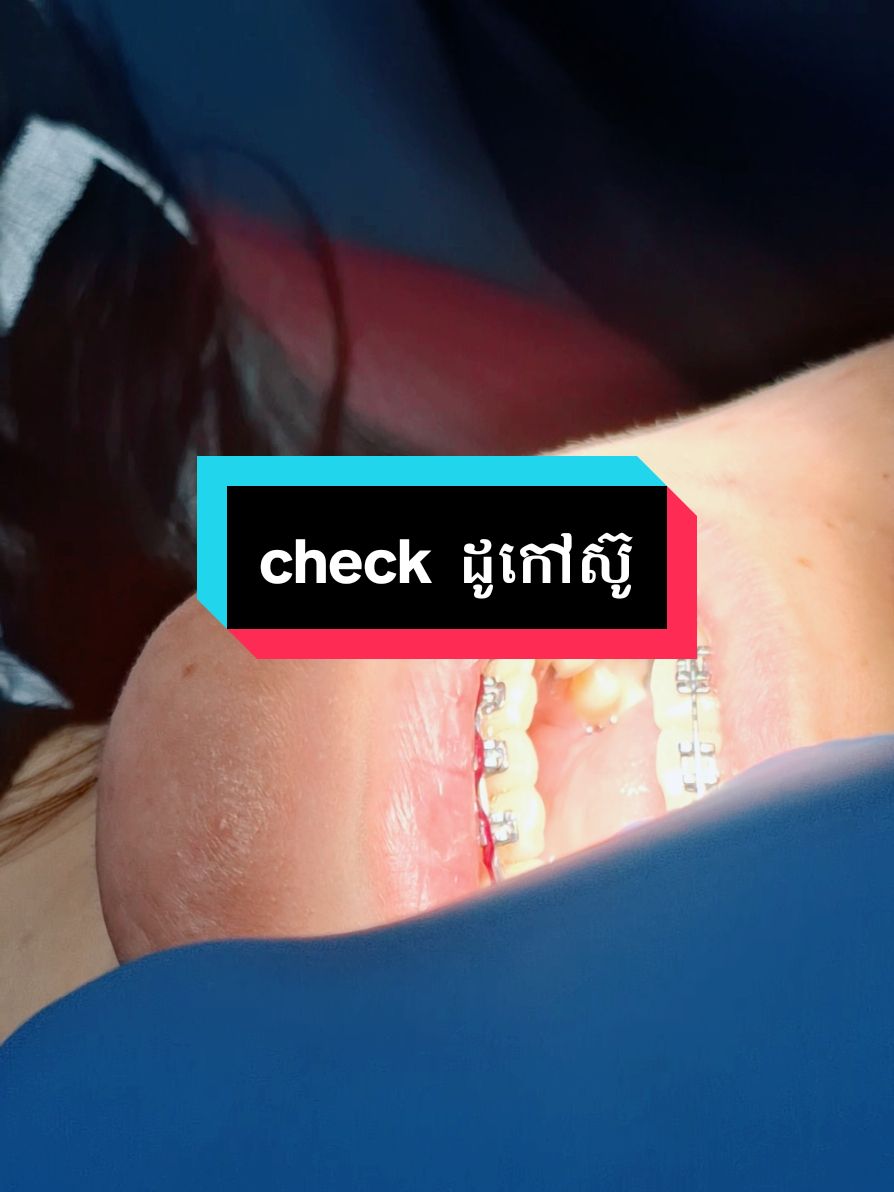 check up ដូកៅស៊ូ #គ្លីនិកធ្មេញគ្រេតស្មាល #greatsmiledentalcambodia #greatsmiledentalclinic #greatsmile