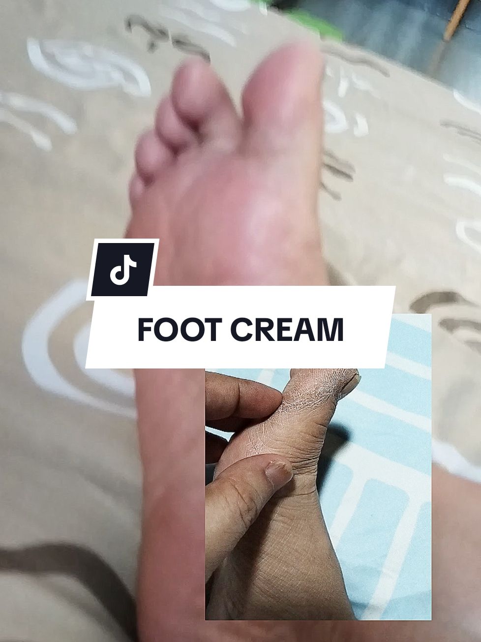 Consistent lang maglagay palagi bago matulog #clicktheyellowbasket #foot #footcare #footcream #anticallus #anticracking #dryskin #skincare #mabrem #calendula #cream #recommendations #freesample #bestseller 