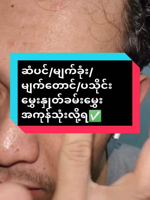 ဆံပင်/မျက်ခုံး/မျက်တောင်/ပသိုင်းမွှေးနှုတ်ခမ်းမွှေးအကုန်သုံးလို့ရ💯#အာမခံအမွှေးပေါက်ဆေး #ဆံပင်ရှည်မြန်ချင်တဲ့သူတွေပဲကြည့်ပေးနော် #ဆံပင်ကျွတ်သက်သာပီးအုံထူစေဖို့ #မျက်တောင်မွှေးပေါက်ဆေး #ဆံပင်ပေါက်ဆေး #မျက်ခုံးမွှေးပေါက်ဆေး #ထိပ်ပြောင်ဆံပင်ပြန်ပေါက်ချင်သူများအတွက် #ထိပ်ပြောင်ထိပ်ကွက်သမားများအတွက် #နှုတ်ခမ်းမွှေးပေါက်ဆေး #ပုသိုင်းမွှေးပေါက်ဆေး #fyp #foryou #fypပေါ်ရောက်စမ်း 