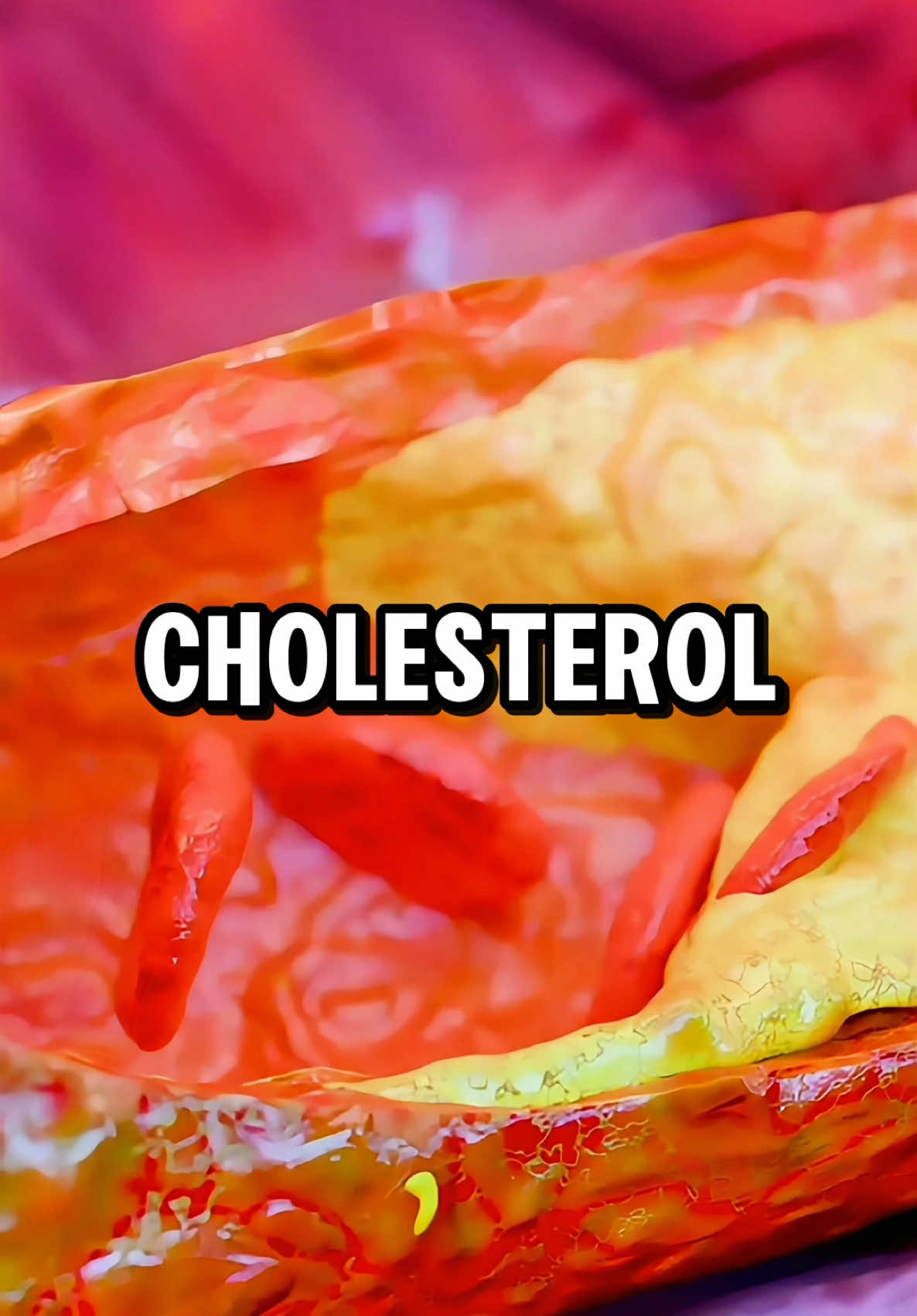 5 foods to lower your cholesterol naturally 🥑🍾.. #health #healthtips #healthylifestyle #Fitness #fruits #viral #realhealth #cholesterol 