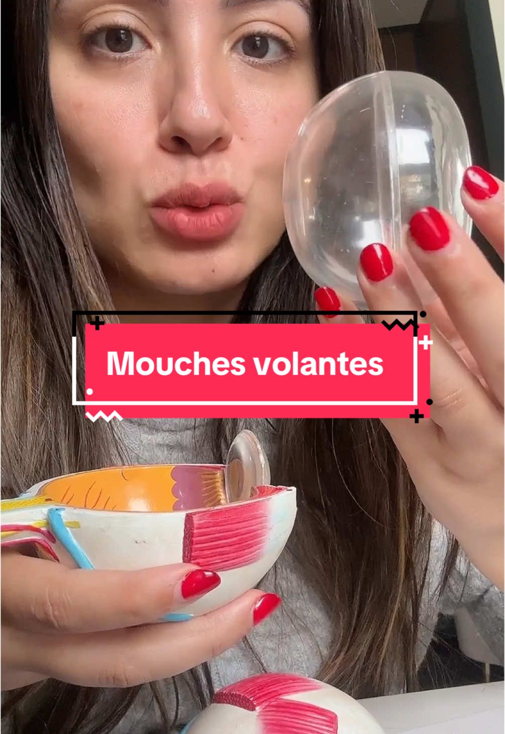 Les mouches volantes #tiktoaroc#algerie#tunisie#sante#health#docteur#doctor#marociane🇲🇦 #doctorsoftiktok #tiktokviral #tiktokmaghreb #tiktokalgeria 