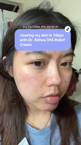 apologies for my previous video freaking everyone out, it was a scare bait marketing tactic 💀 @dr.althea_official #345reliefcream #kbeauty #dralthea345cream #dralthea #kbeauty #acne #acnerelief 